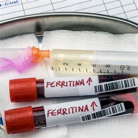 Esami Del Sangue Come Leggere I Valori Sierologici Avis Regionale