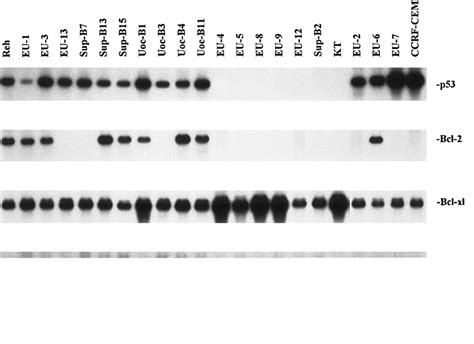 Northern Blot Analysis Of P53 Bcl 2 Bcl Xl And Bax Mrna From 22 All