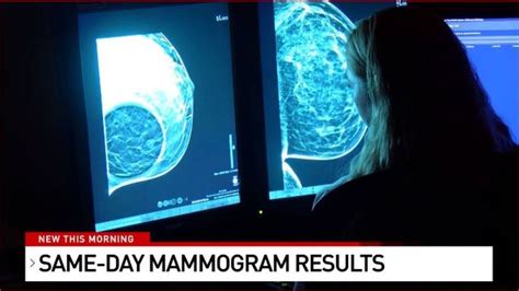 Local hospital now offers same-day mammogram results