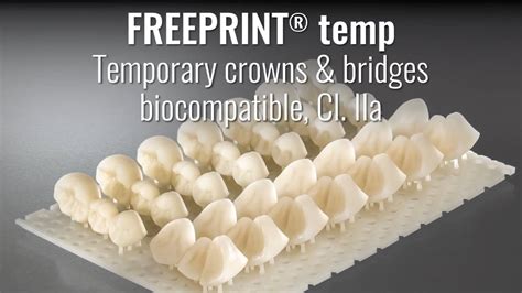 Freeprint Temp 3D Printing Of High Quality Tooth Crowns Pontics