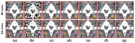 Applied Sciences Free Full Text Sparse View Computed Tomography Reconstruction Based On A