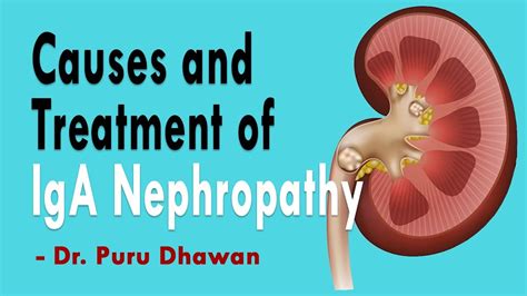 Causes And Treatment Of Iga Nephropathy Youtube