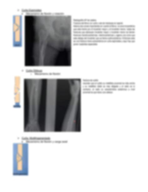 Solution Trazo De Fractura Studypool