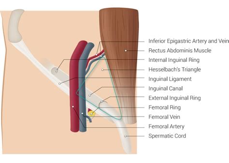 [figure Inguinal Region This Image Includes The ] Statpearls