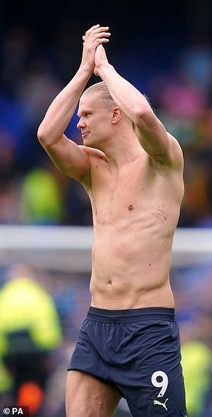 Manchester City Shirtless Erling Haaland Shows Off Battle Scars From