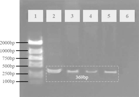 Gel electrophoresis result of PCR products with the proposed PCR ...