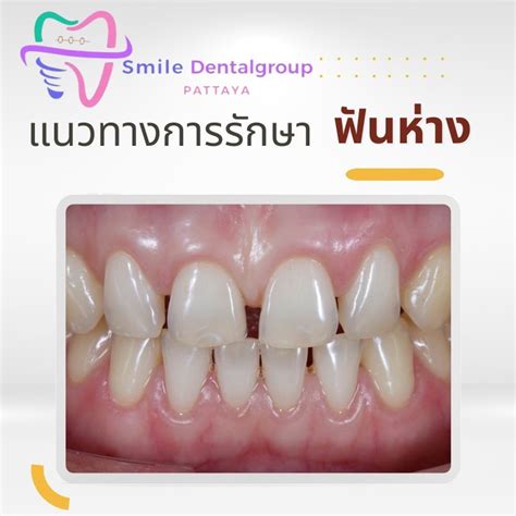 Smile Dental Group Pattaya