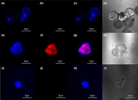 In Vitro Sepsis Upregulates Nociceptin Orphanin Fq Receptor Expression