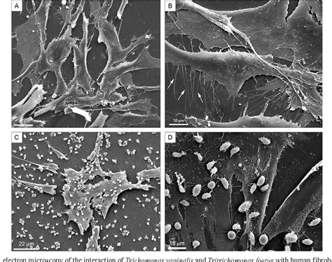 Figure 1 From Trichomonas Vaginalis And Tritrichomonas Foetus Interaction With Fibroblasts And