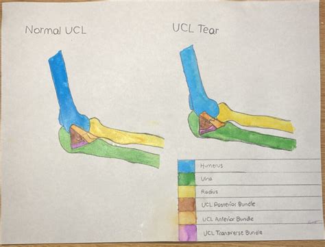 A Guide to Ulnar Collateral Ligament Injuries – Human STEAM