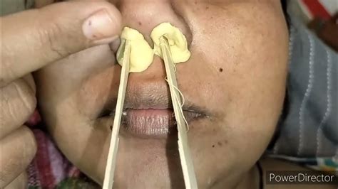 कैसे होती है नोज वैक्सिंगnose Hair Waxingnosenosewaxingpoojachaudhary5447 Pummybeautyworld