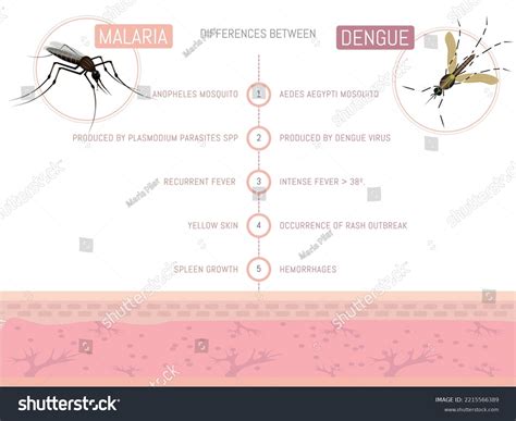 Infografia Dengue M S De Vectores De Stock Y Arte Vectorial Con