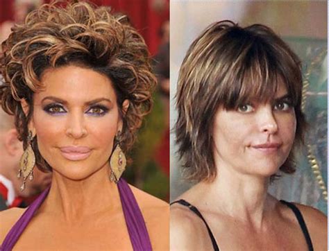 Lisa Rinna Lip Surgery Before And After Photos