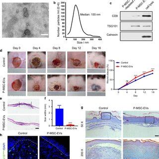 MiR 145 5p Enhanced The Proliferation And Migration Of HG Induced HDFs