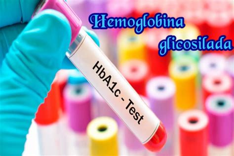 Qu Es La Hemoglobina Glicosilada Integral Medical Clinic