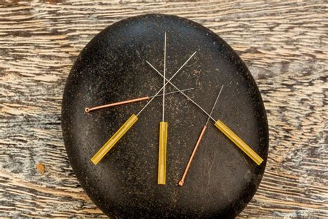 Acupuncture needles Stock Photo by ©ginasanders 58527273