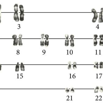 Karyotype Analysis Of Emsc A G Banded Karyotype Of Intact Emsc B