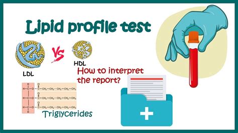 Lipid Profile Test How To Read Report What Is Good And Bad