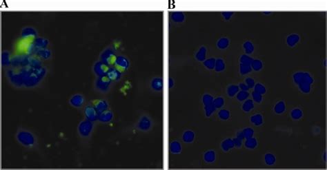 Immunofluorescent Staining Of M Genitalium Infected Pbmc Using Purified