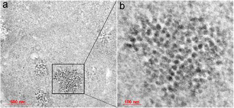 Transmission Electron Micrographs Of Ultrathin Section Of The