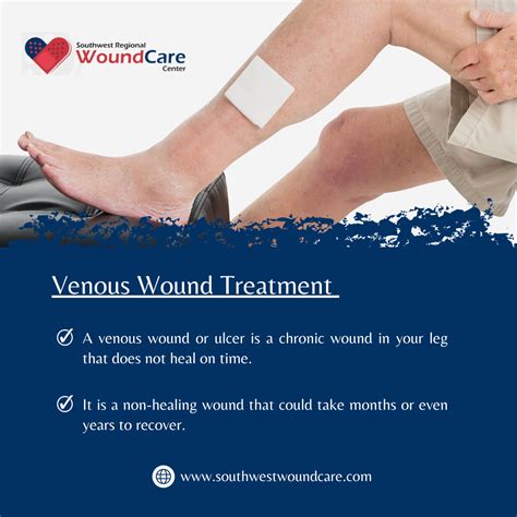 Venous Wound Diagnosis and Treatment in Lubbock, TX – Southwest ...