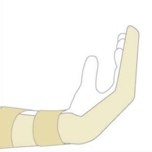 Jersey Finger – Carolyn Yang, MD