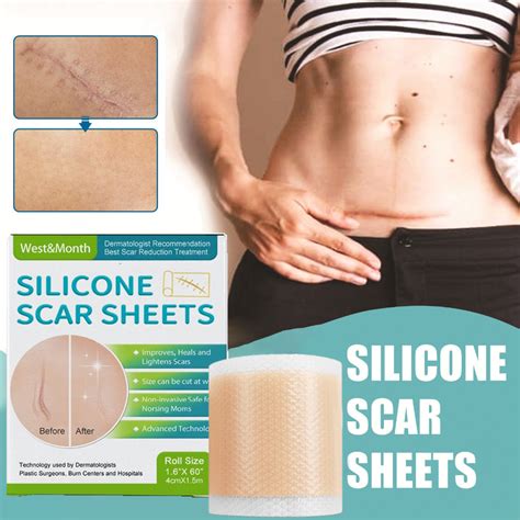 Silicone Scar Tape Non Irritating Self Adhesive Scar Removal Tape Patch