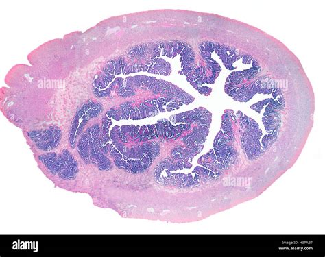 Parts Of Fallopian Tube Anatomy