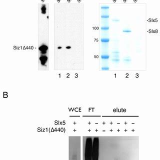 The STUbL Subunit Slx5 Forms A Complex With The SUMO Ligase Siz1 A