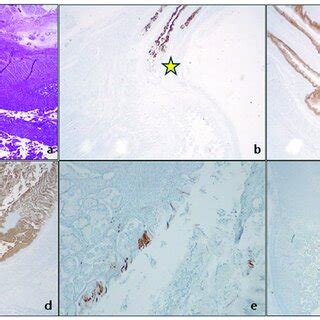 Original autopsy fetal case, 21 weeks of gestation. GEJ (yellow star).... | Download Scientific ...