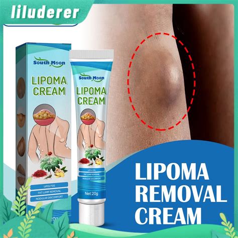 South Moon G Lipoma Ointment Treatment Cream Natural Plant Fat