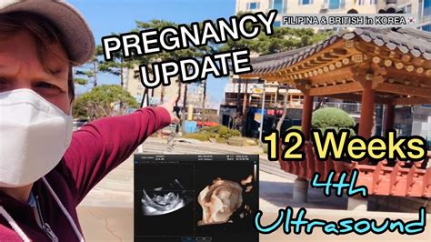 12th Week Pregnancy Update 4th Ultrasound Sonogram Vlog ️the