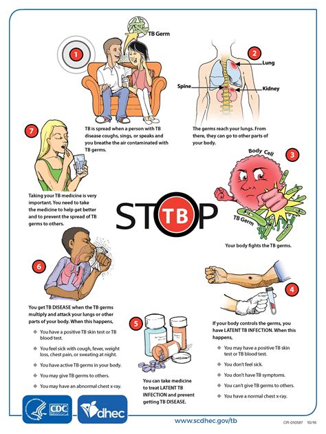 Tuberculosis Resources For The Public Scdhec