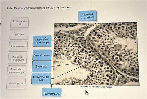 Solved Label The Photomicrograph Based On The Hints Chegg