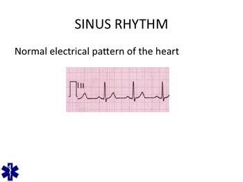 Emt Emr Cardiovascular Emergencies By Bruce Vincent Tpt