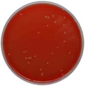 PP0110 Campylobacter Selective Agar Skirrow E O Laboratories Ltd