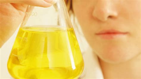 Things You Need To Know About Urine Osmolality Test - Med Scoop Daily