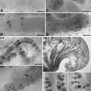 Light Micrographs Of 50 M Thick Vibratome Sections From Prenatal E13