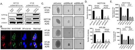 Cancers Free Full Text Pgc 1β And Errα Promote Glutamine Metabolism