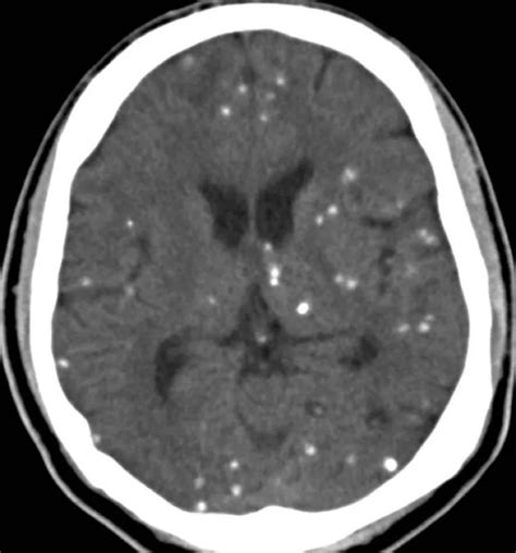 Journal Of Brown Hospital Medicine On Twitter Diagnosis RadRounds