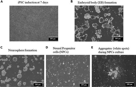 Micrographs Of Cells At Different Stages During The Induction Of Hipscs