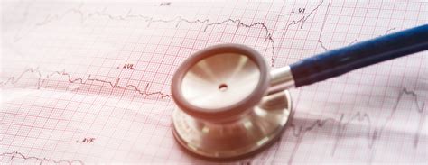 catheter ablation conditions treatments ucsf health