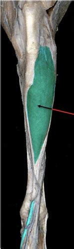 Muscles Of The Crus Of The Pelvic Limb Flashcards Quizlet