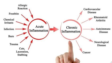 Chronic Inflammation Symptoms Health Tips