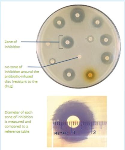 Microbiology Altura Exam Flashcards Quizlet