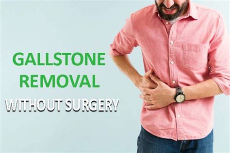 The Ultimate Methods For Gallstone Removal Without Surgery By Suman