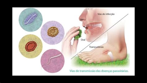 Saneamento Básico E Parasitoses Associadas Ascaridíase Youtube