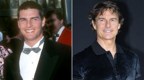 Top 37 Tom Cruise Nose Job Update