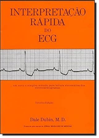 Amazon In Buy Rapid Interpretation Of Ekg S By Dale Dubin