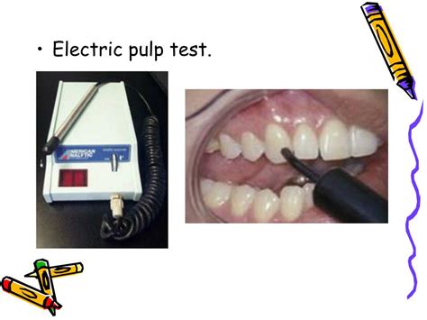 Ppt Endodontic Diagnosis And Treatment Planning Powerpoint